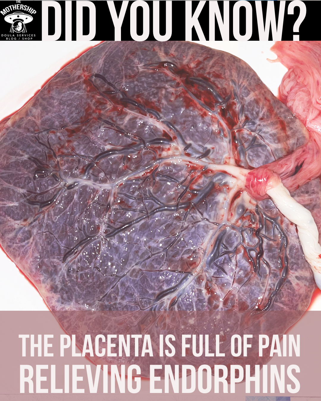 Placenta Encapsulation In-Person Training | Mott Haven, Bronx, NY