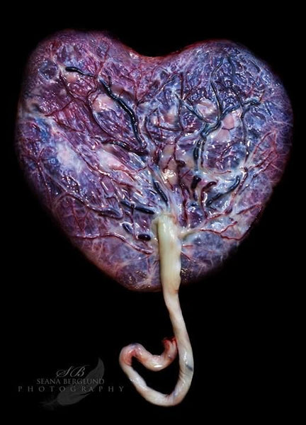 Placenta Services - Pill Encapsulation, Tinctures, &amp; Salves – The 